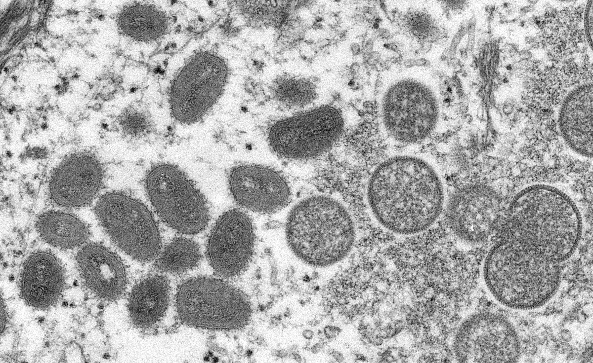 ВОЗ: вспышка оспы обезьян в&nbsp;Европе представляет высокий риск