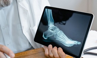 Минские медики начнут использовать ИИ для изучения рентген-снимков 