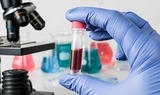 Ученые нашли способ обнаружить рак за три года до появления первых симптомов