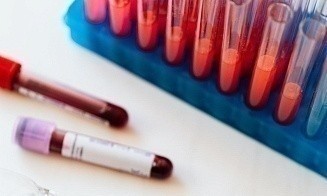 В частных лабораториях уже можно сдать уникальный онкотест на 60 видов рака. Рассказываем как