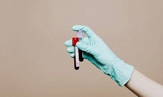 В ЕАЭС упростили таможенное декларирование органов человека и крови